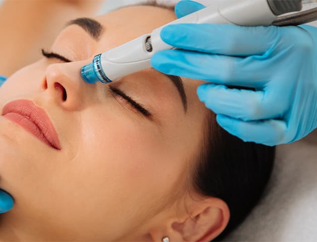 Dermapen Treatment