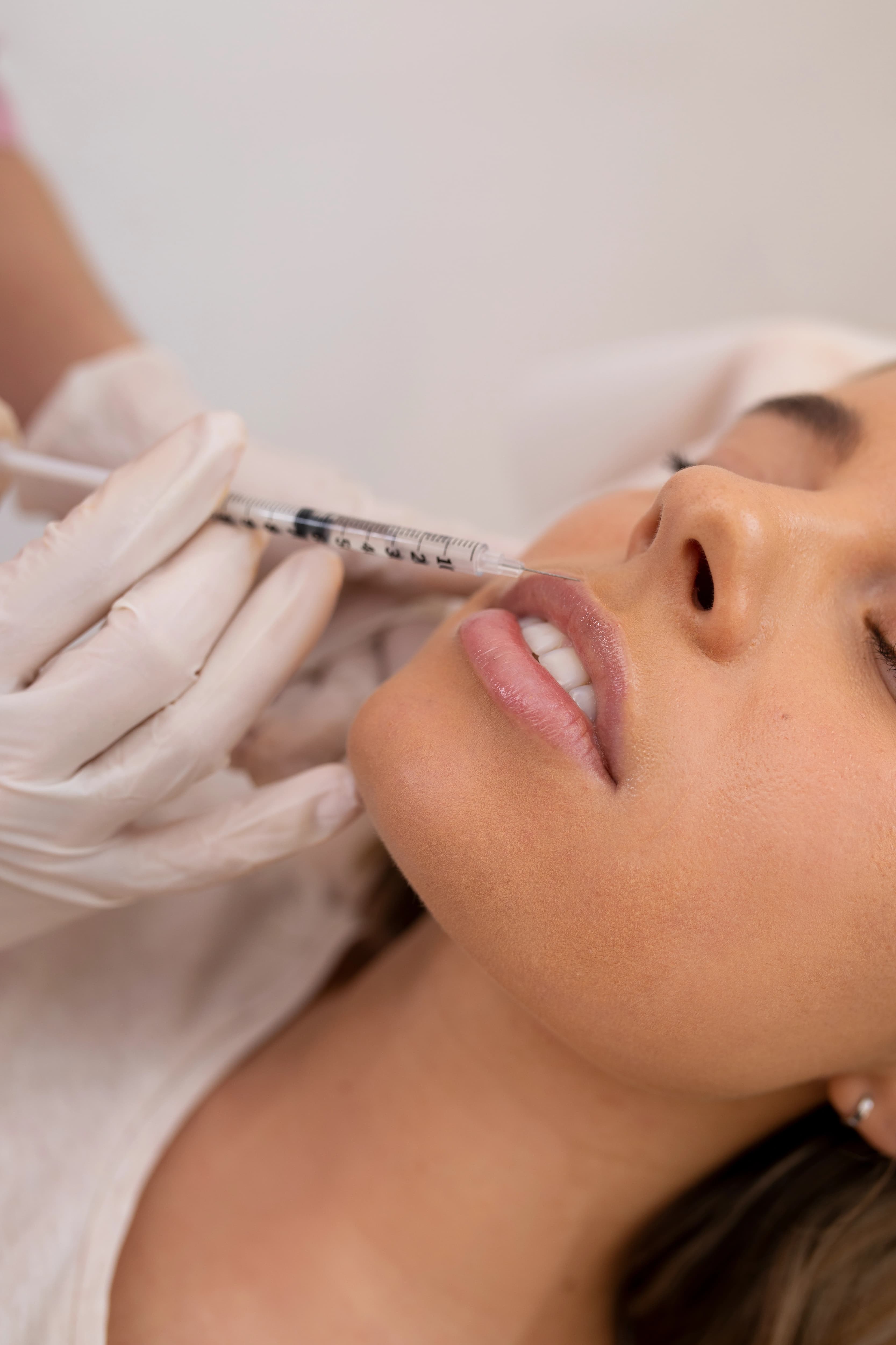 Derma Fillers treatment