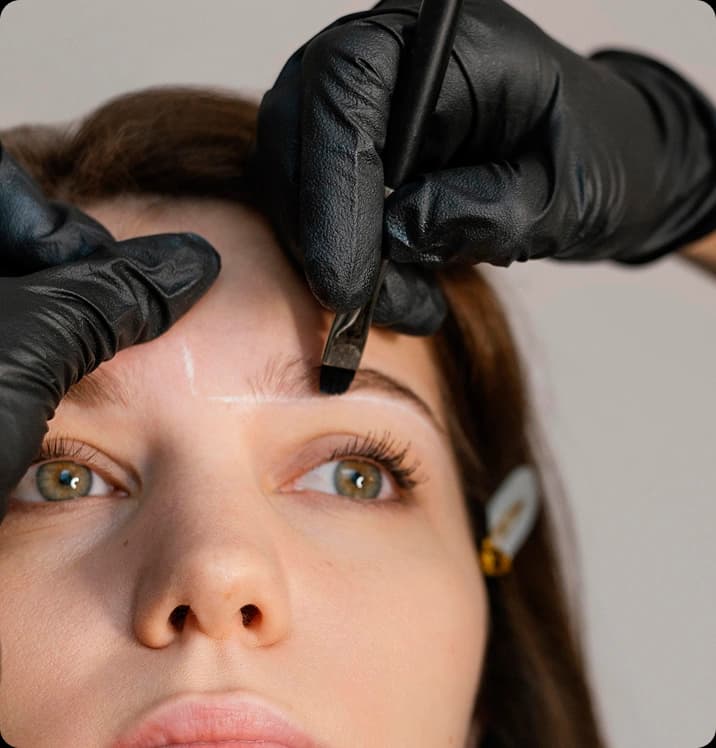 Facial Hair Transplant process