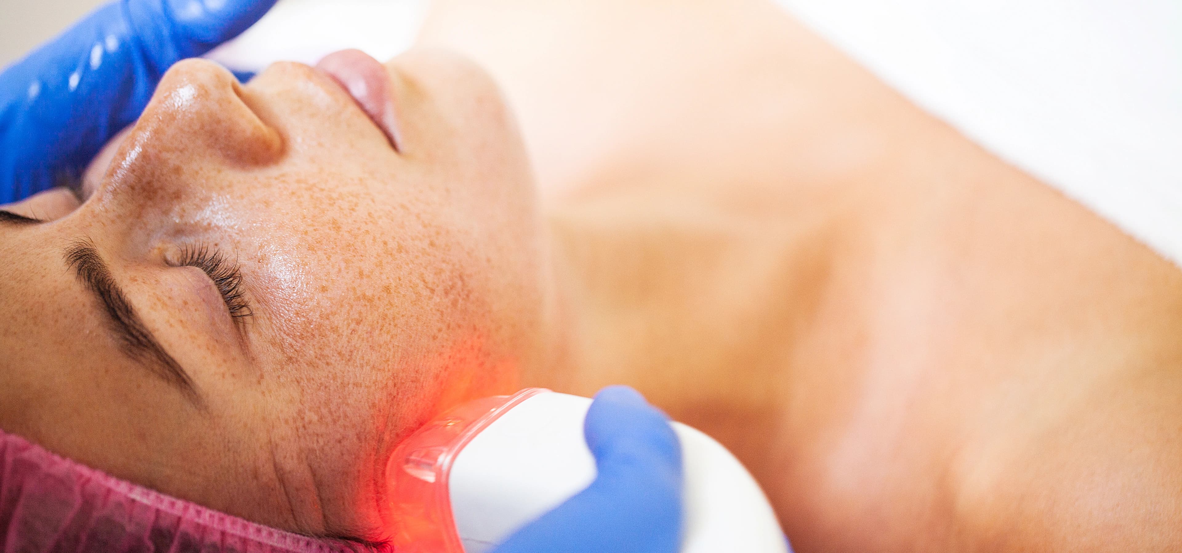 Low Level Laser Therapy for Hair Growth