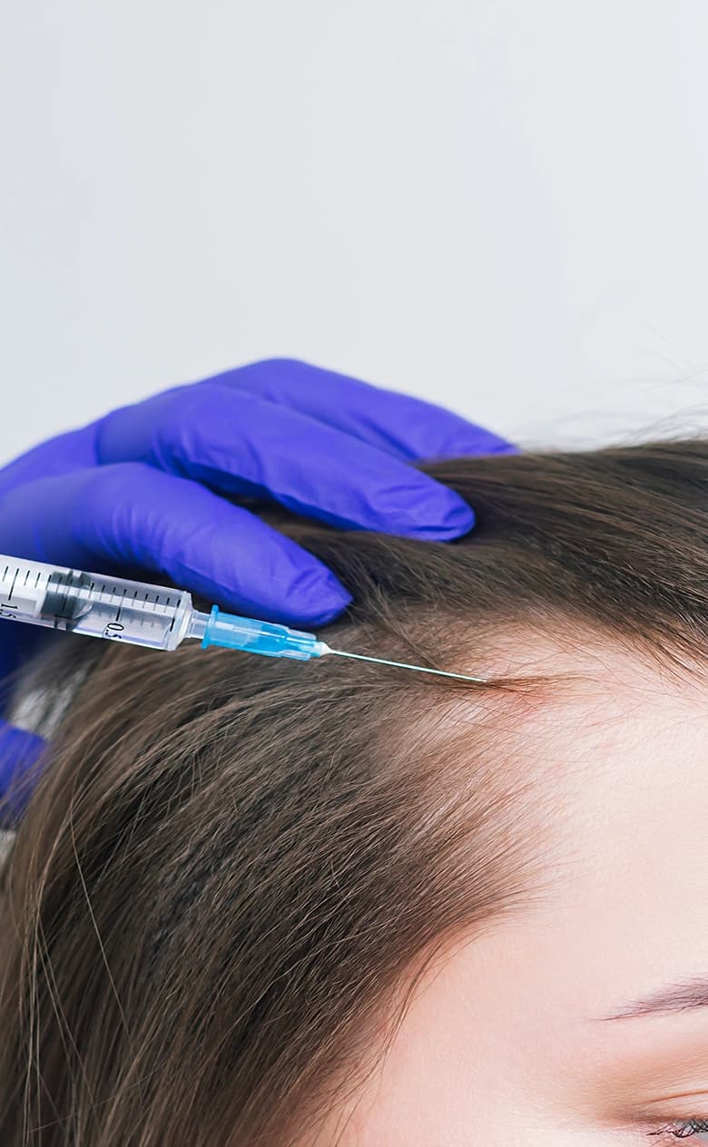 Microneedling for Hair Loss