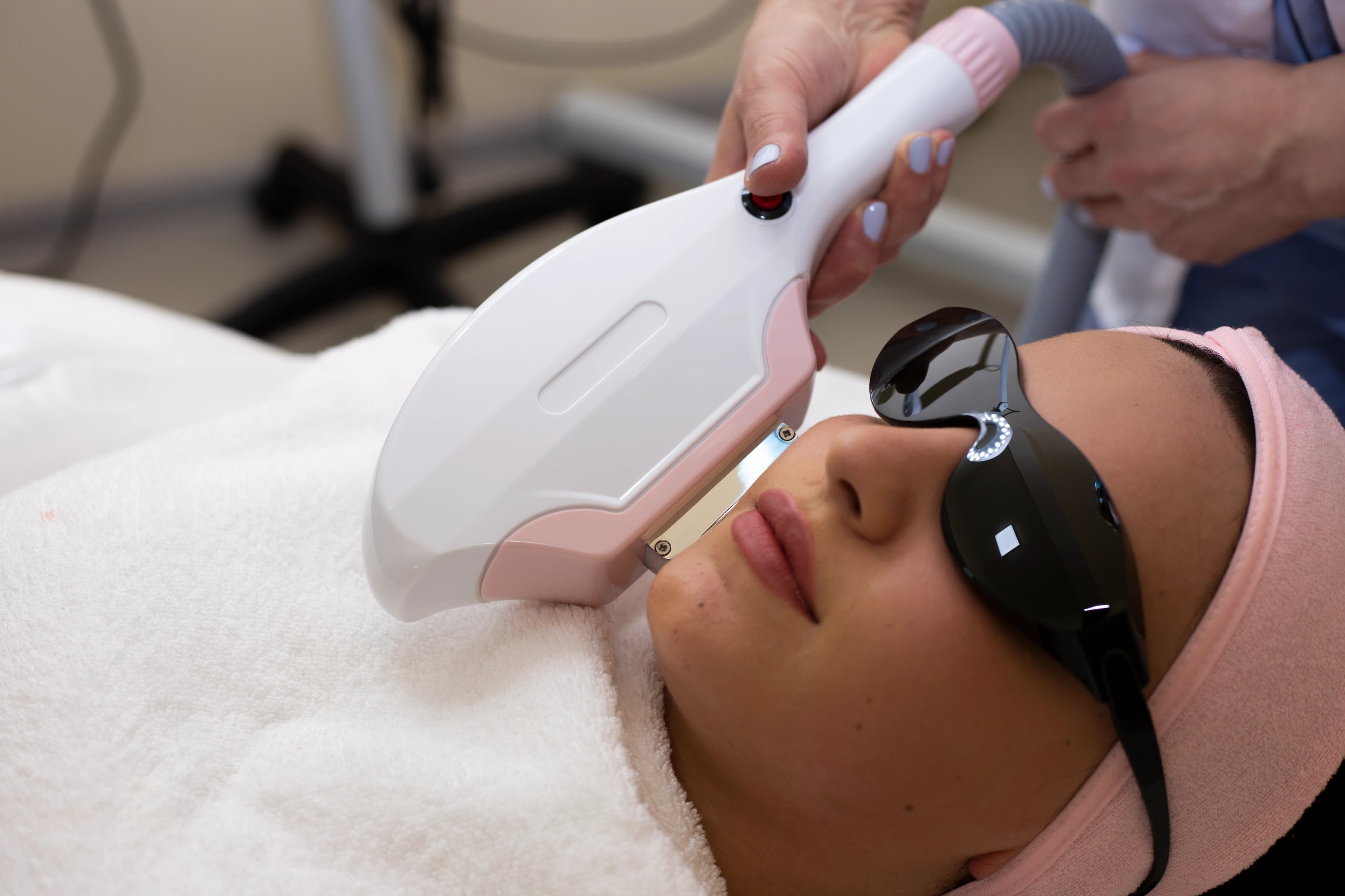 Photo Facial treatment