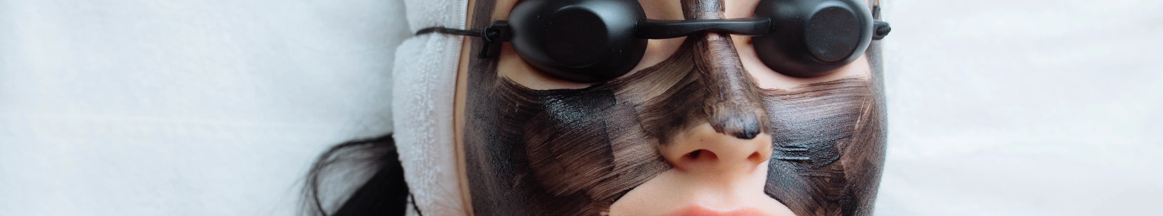 Carbon Facial procedure