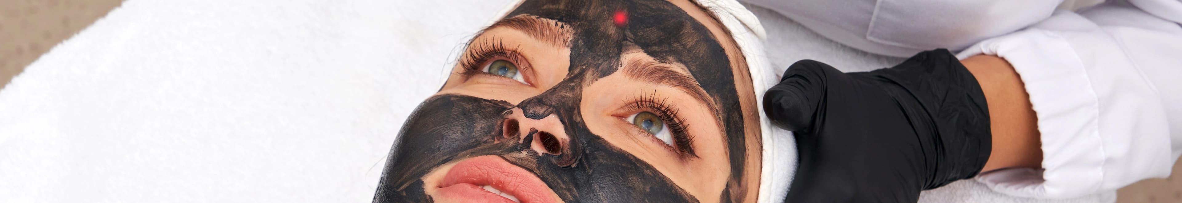 Carbon Facial results