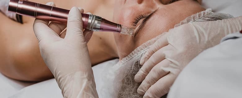 Collagen Induction Therapy