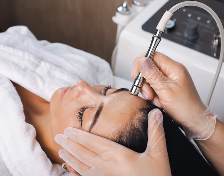 microdermabrasion treatment
