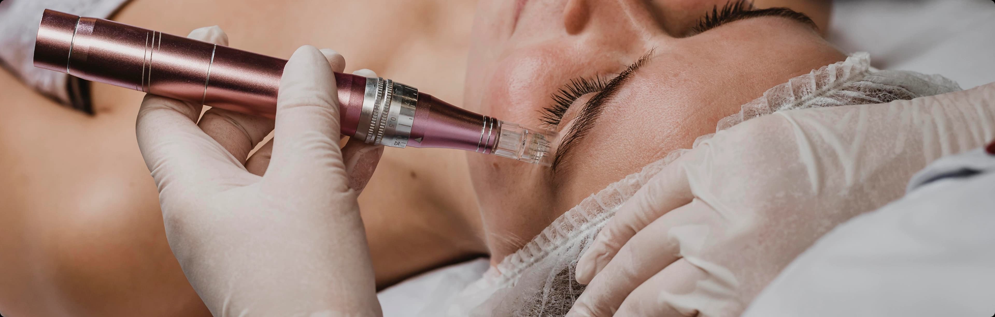 microdermabrasion facial