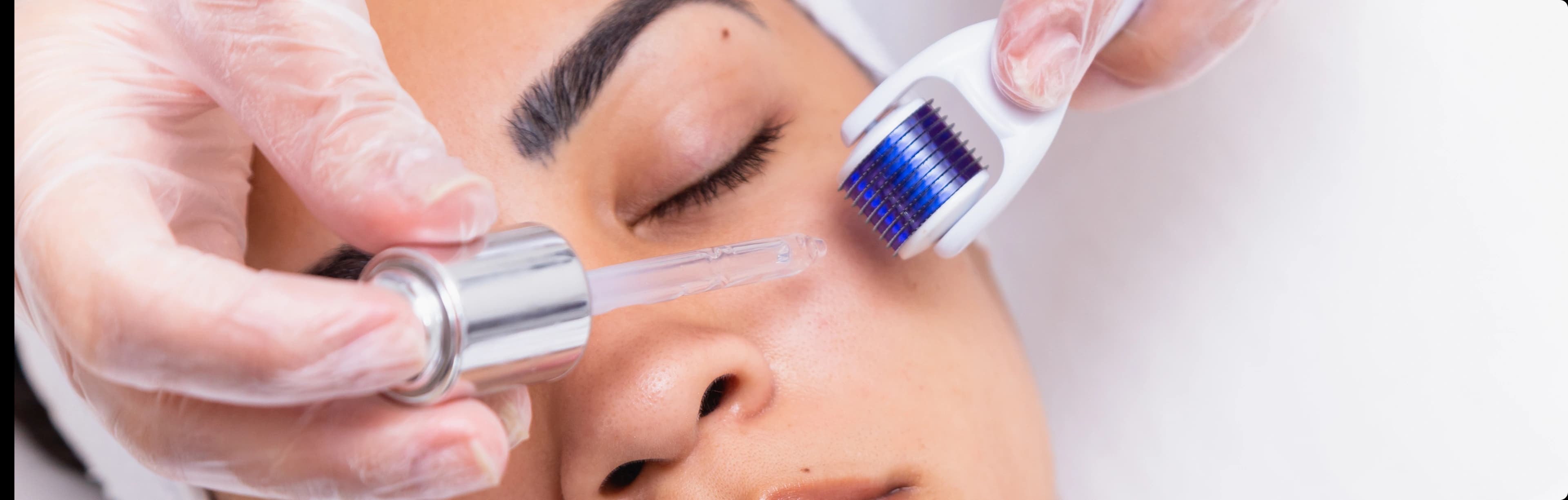Microneedling treatment benefits