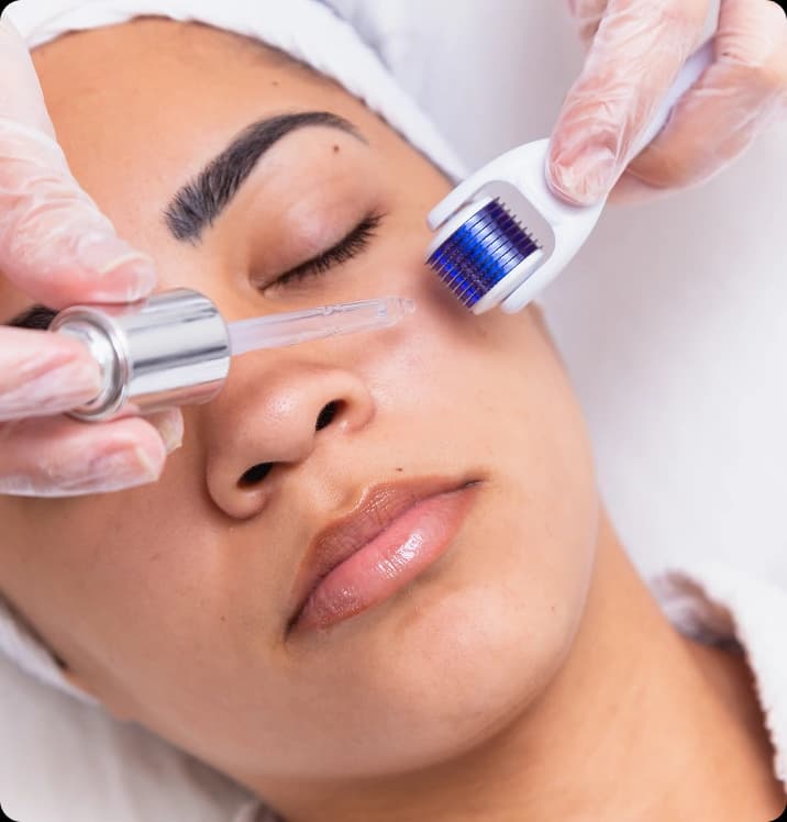Microneedling treatment benefits