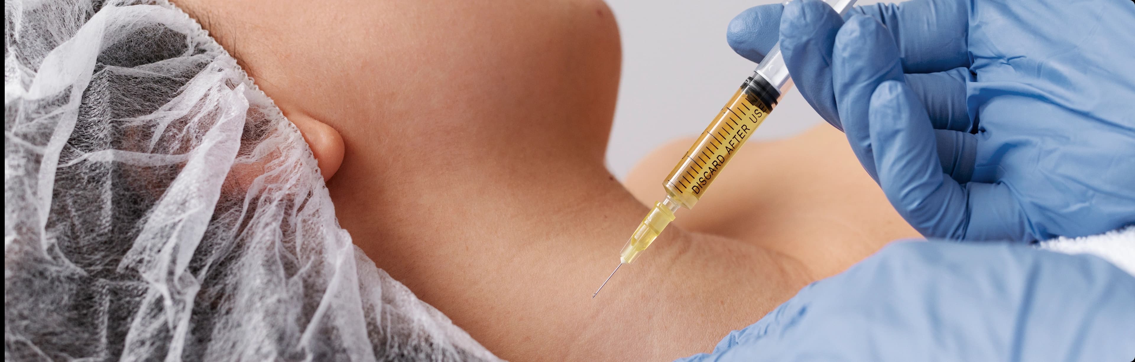 PRP treatment benefits