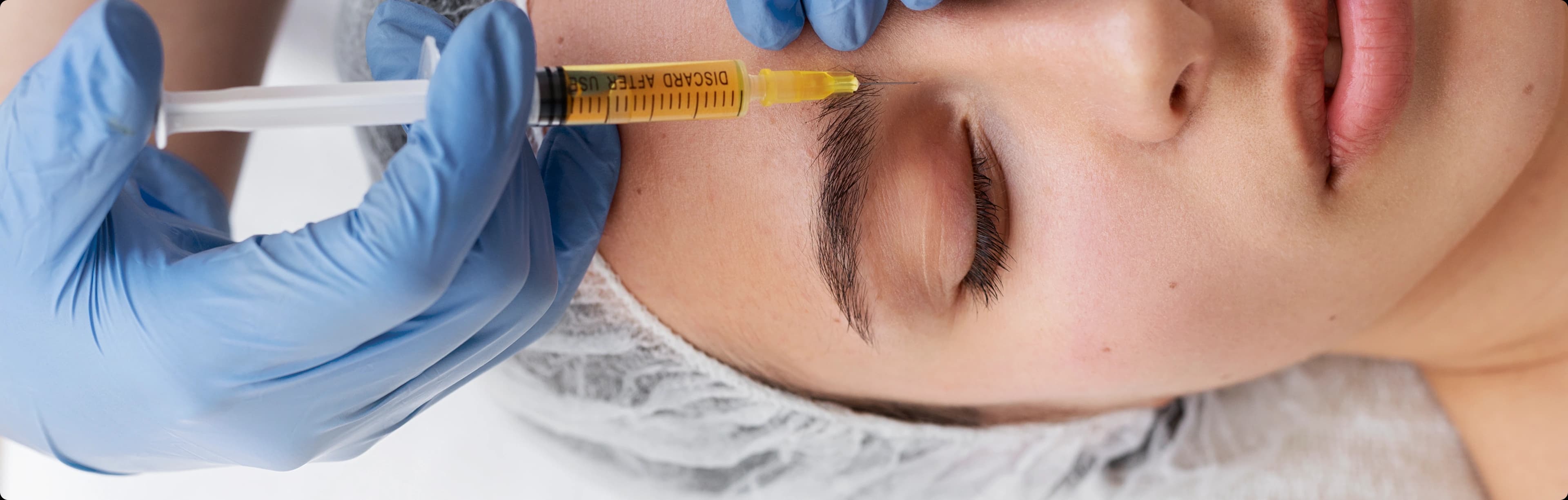 PRP treatment process