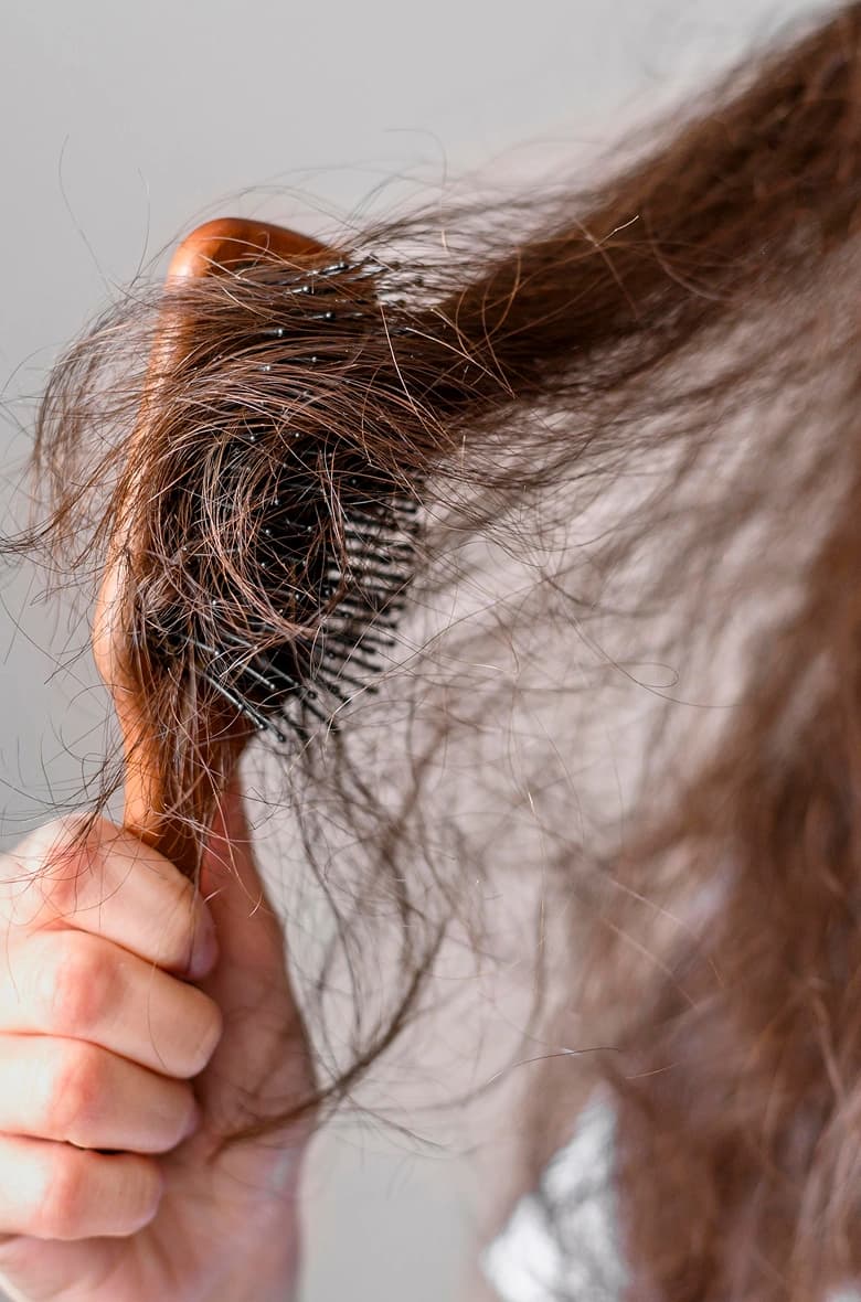 Hair Loss Treatment