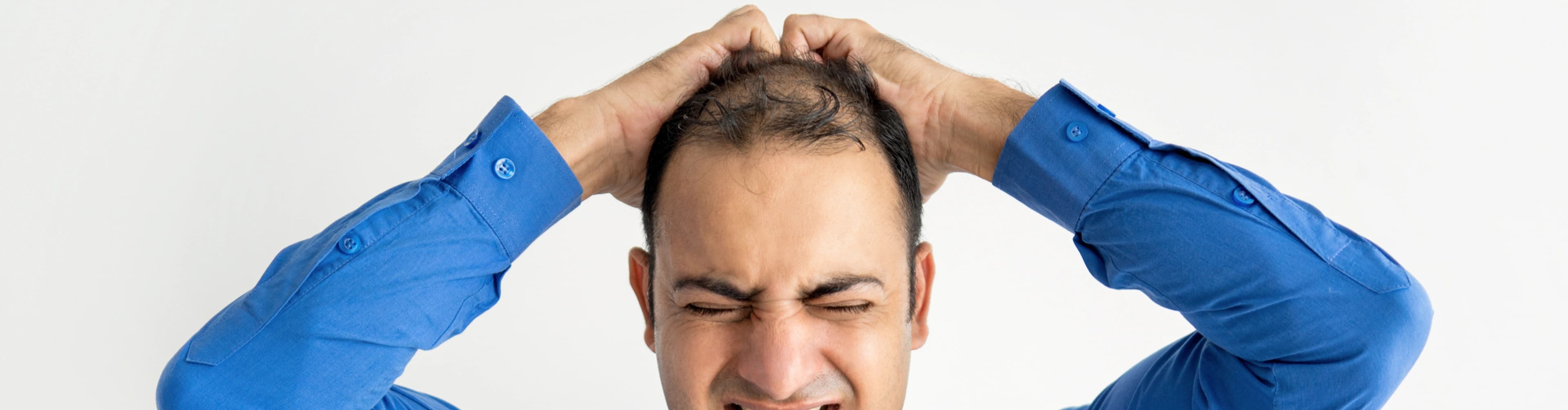 Hair Loss Treatment Overview