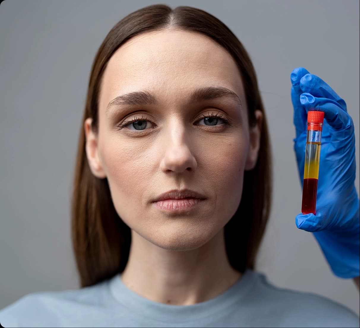 Bio-PRP (with Growth Boosters)