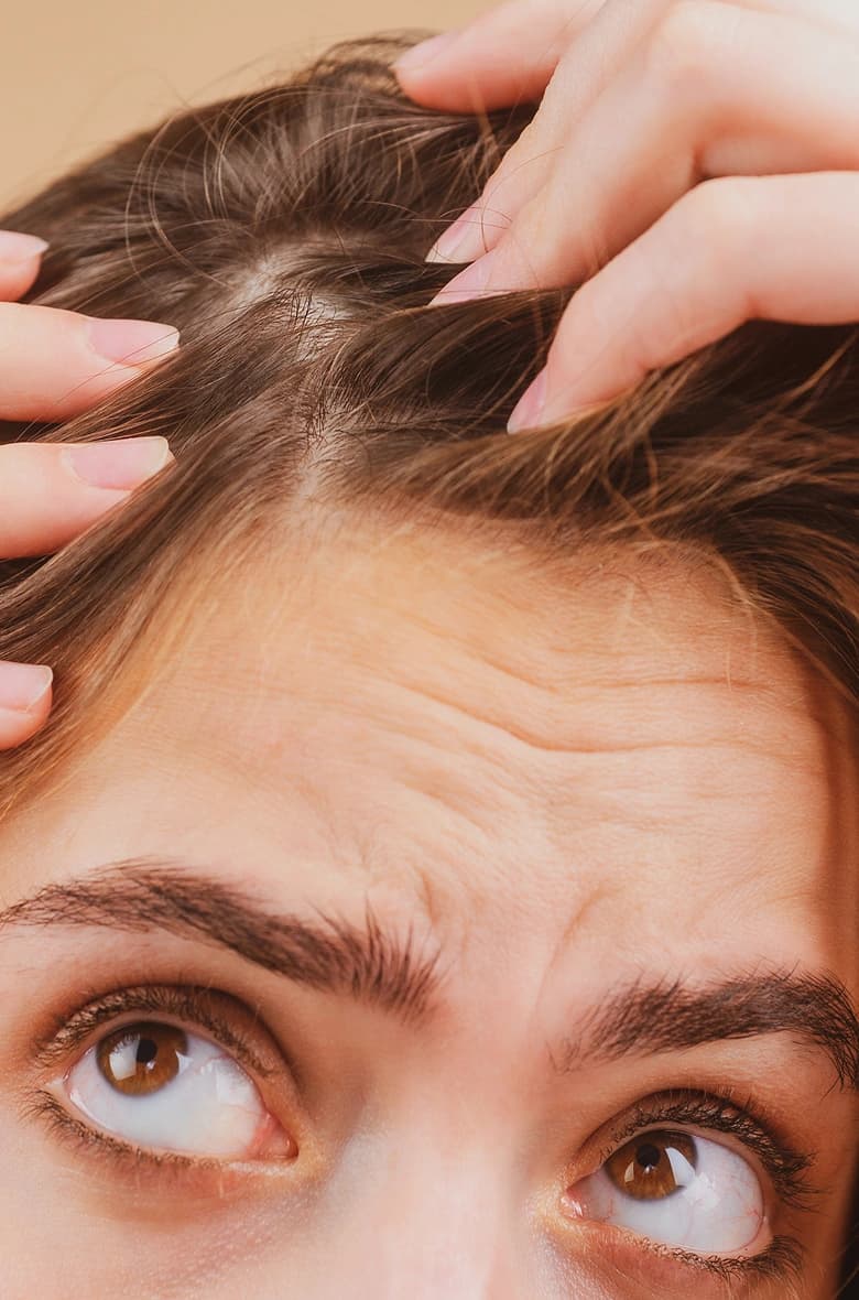 Hair Thinning Treatment