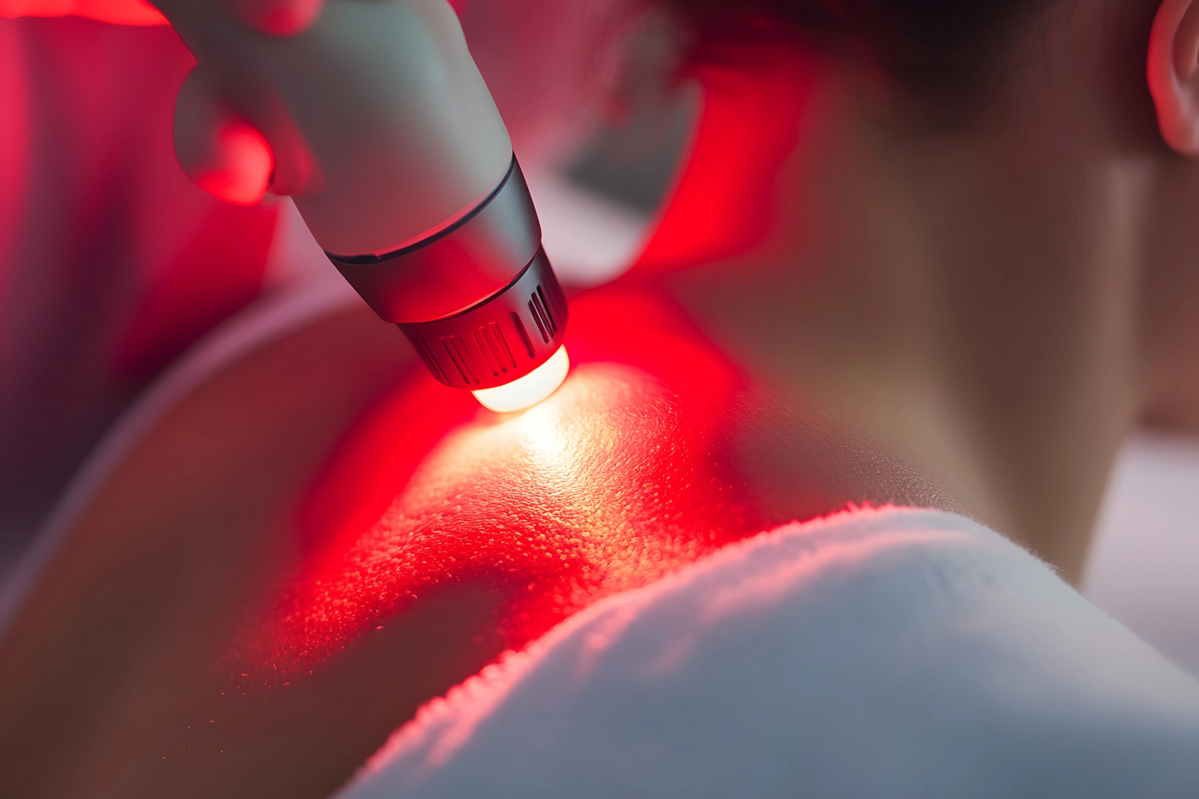 Low-Level Laser Therapy treatment