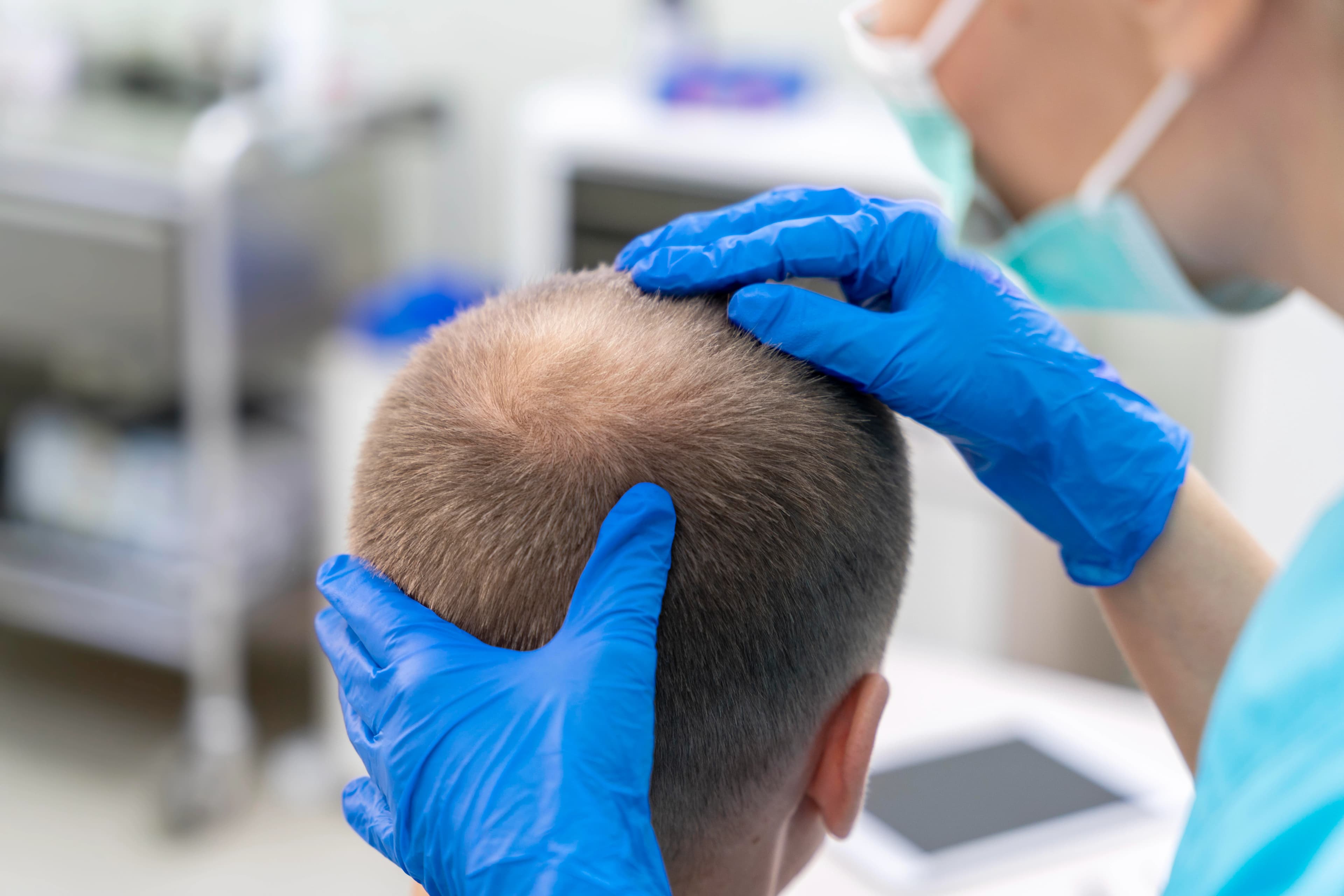 Non-surgical hair replacement