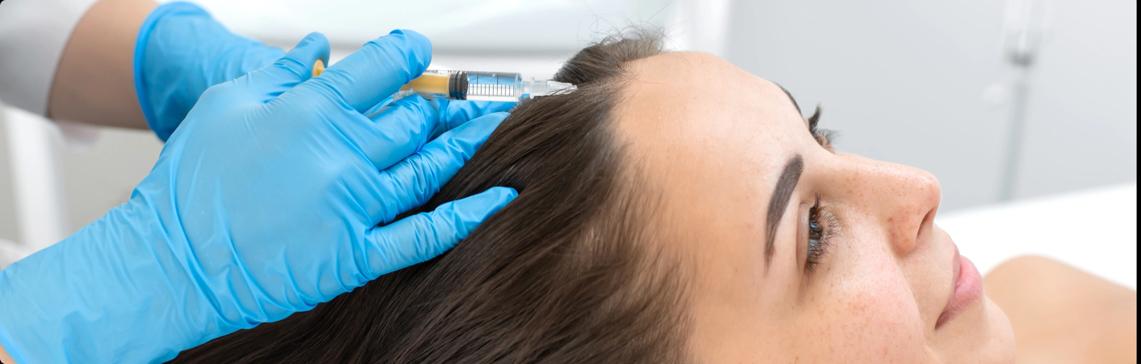 PRP hair treatment benefits