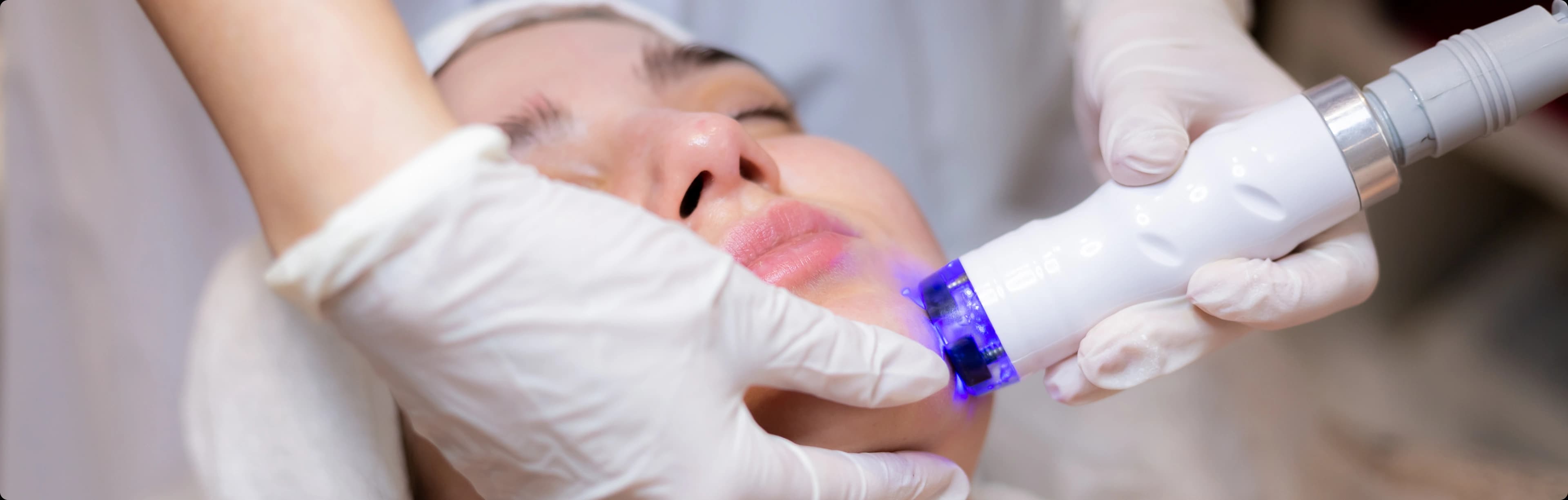 Laser Skin Resurfacing Treatment