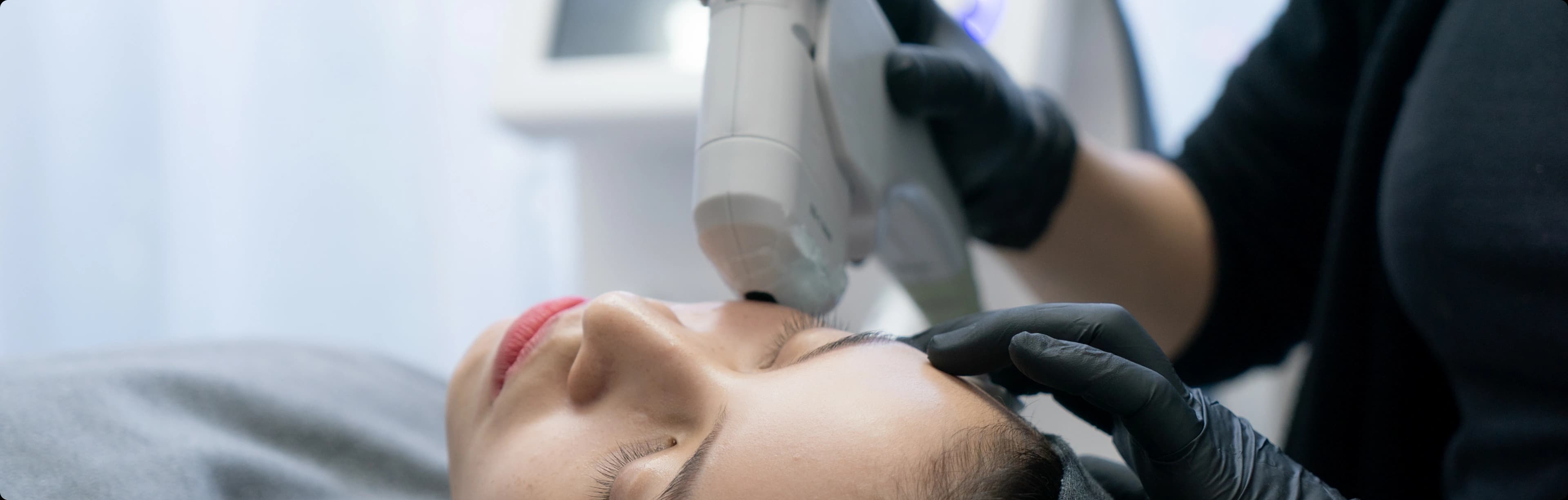 laser skin resurfacing treatments