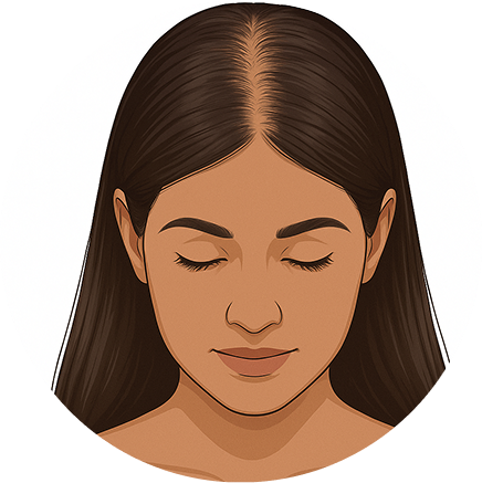 Female Pattern Hair Loss